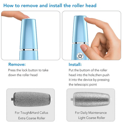 🔥last day sale 50% off🔥Electric callus remover for fee