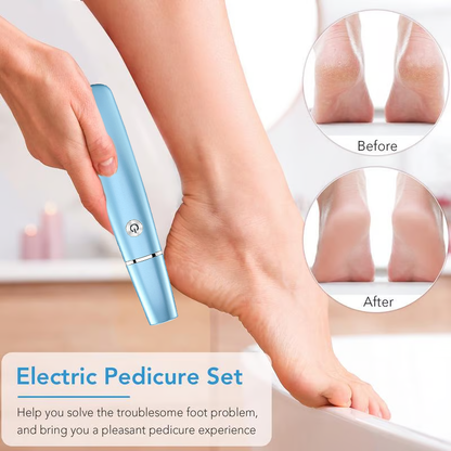 🔥last day sale 50% off🔥Electric callus remover for fee
