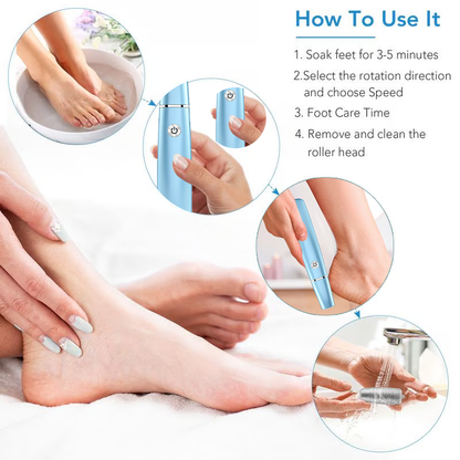 🔥last day sale 50% off🔥Electric callus remover for fee