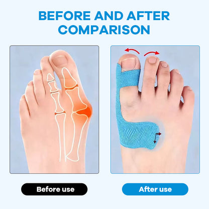 ✨Wear Any Shoes You Love—Without the Bunion Pain! 👠💃