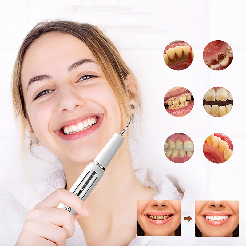 🦷⚡ Ultrasonic Tartar Remover — Gentle, Rechargeable & Waterproof Oral Care Tool