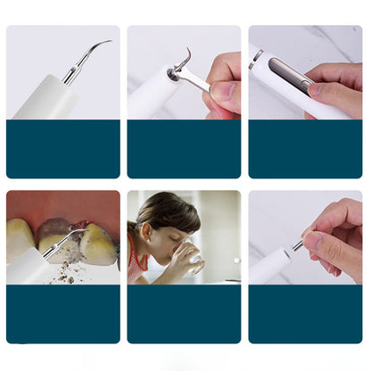 🦷⚡ Ultrasonic Tartar Remover — Gentle, Rechargeable & Waterproof Oral Care Tool
